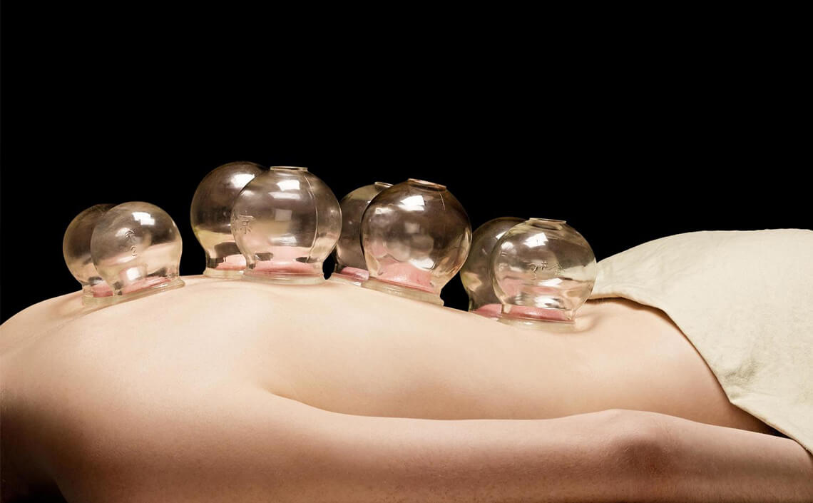 best cupping therapy in chennai